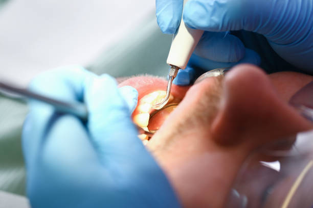 Best Emergency Broken Tooth Repair in Leesburg, GA