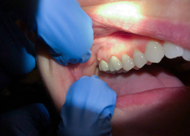 Best Pediatric Emergency Dentist in Leesburg, GA